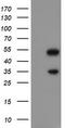 Snail Family Transcriptional Repressor 2 antibody, LS-C175161, Lifespan Biosciences, Western Blot image 