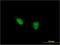 Teashirt Zinc Finger Homeobox 1 antibody, H00010194-M07, Novus Biologicals, Immunofluorescence image 