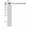 Transforming Growth Factor Beta Receptor 3 antibody, LS-C386394, Lifespan Biosciences, Western Blot image 