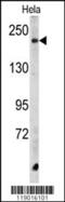 Carboxypeptidase D antibody, 62-430, ProSci, Western Blot image 