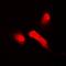 Btrcp2 antibody, orb341357, Biorbyt, Immunofluorescence image 