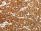 SWI/SNF Related, Matrix Associated, Actin Dependent Regulator Of Chromatin, Subfamily A, Member 4 antibody, CSB-PA843993, Cusabio, Immunohistochemistry paraffin image 