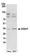 N(G),N(G)-dimethylarginine dimethylaminohydrolase 1 antibody, A305-390A, Bethyl Labs, Western Blot image 
