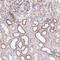 LIM And Calponin Homology Domains 1 antibody, HPA063840, Atlas Antibodies, Immunohistochemistry paraffin image 