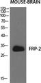 Secreted Frizzled Related Protein 2 antibody, PA5-50962, Invitrogen Antibodies, Western Blot image 