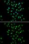 CXXC Finger Protein 1 antibody, GTX53967, GeneTex, Immunofluorescence image 