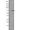 Interleukin 12 Receptor Subunit Beta 1 antibody, abx149063, Abbexa, Western Blot image 