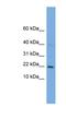 Protein Phosphatase 1 Regulatory Subunit 17 antibody, NBP1-79480, Novus Biologicals, Western Blot image 