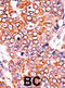 CDKN2A antibody, abx031884, Abbexa, Immunohistochemistry frozen image 