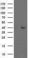 Aldolase, Fructose-Bisphosphate B antibody, MA5-25545, Invitrogen Antibodies, Western Blot image 