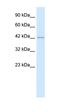 Histone Deacetylase 8 antibody, orb329785, Biorbyt, Western Blot image 