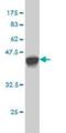 Glucosidase Alpha, Acid antibody, H00002548-M01, Novus Biologicals, Western Blot image 