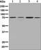 Acyl-CoA Synthetase Short Chain Family Member 2 antibody, ab133664, Abcam, Western Blot image 
