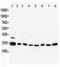 RAB5A, Member RAS Oncogene Family antibody, LS-C312920, Lifespan Biosciences, Western Blot image 