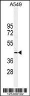 Nucleolar Protein 4 Like antibody, 55-546, ProSci, Western Blot image 