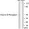 Vitamin D Receptor antibody, LS-B7259, Lifespan Biosciences, Western Blot image 