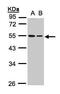 Tubulin Beta 1 Class VI antibody, PA5-21826, Invitrogen Antibodies, Western Blot image 