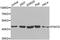 Phosphoribosylaminoimidazole Carboxylase And Phosphoribosylaminoimidazolesuccinocarboxamide Synthase antibody, LS-C334729, Lifespan Biosciences, Western Blot image 