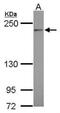 Complement C4A (Rodgers Blood Group) antibody, NBP2-14893, Novus Biologicals, Western Blot image 