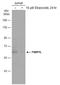 Formin Binding Protein 1 Like antibody, GTX132563, GeneTex, Western Blot image 