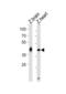 Homeobox protein Hox-A1a antibody, abx034828, Abbexa, Western Blot image 
