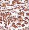 Origin Recognition Complex Subunit 3 antibody, LS-C163270, Lifespan Biosciences, Immunohistochemistry paraffin image 