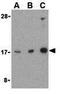 GTP-binding protein Rheb antibody, GTX31713, GeneTex, Western Blot image 