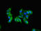 Complement C1q A Chain antibody, LS-C677339, Lifespan Biosciences, Immunofluorescence image 