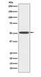 Inhibin Subunit Beta B antibody, M03838, Boster Biological Technology, Western Blot image 