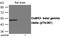 Calcium/Calmodulin Dependent Protein Kinase II Beta antibody, MBS9411684, MyBioSource, Western Blot image 