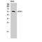 Activin A Receptor Like Type 1 antibody, LS-C381999, Lifespan Biosciences, Western Blot image 