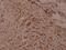 WNK1 antibody, PA5-36701, Invitrogen Antibodies, Immunohistochemistry paraffin image 