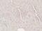 Hepatocellular carcinoma-associated protein TD26 homolog antibody, PA5-38043, Invitrogen Antibodies, Immunohistochemistry frozen image 
