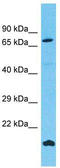 Fibronectin Type III Domain Containing 7 antibody, TA337312, Origene, Western Blot image 