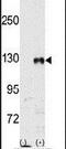 EPH Receptor B1 antibody, PA5-14605, Invitrogen Antibodies, Western Blot image 