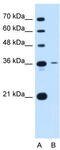 Tetraspanin 5 antibody, TA339022, Origene, Western Blot image 