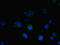 Transmembrane 9 Superfamily Member 1 antibody, LS-C676599, Lifespan Biosciences, Immunofluorescence image 