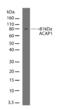 Arf-GAP with coiled-coil, ANK repeat and PH domain-containing protein 1 antibody, 710012, Invitrogen Antibodies, Western Blot image 