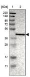 PHD Finger Protein 11 antibody, NBP1-88684, Novus Biologicals, Western Blot image 