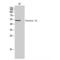 Coronin 1A antibody, LS-C382853, Lifespan Biosciences, Western Blot image 