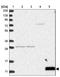 Fc Fragment Of IgE Receptor Ig antibody, NBP1-85959, Novus Biologicals, Western Blot image 