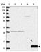 Fc Fragment Of IgE Receptor Ig antibody, NBP1-85959, Novus Biologicals, Western Blot image 