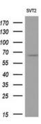 Natriuretic Peptide Receptor 3 antibody, MA5-25065, Invitrogen Antibodies, Western Blot image 