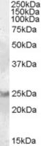 Neutral cholesterol ester hydrolase 1 antibody, 46-619, ProSci, Immunofluorescence image 