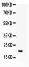 Adenine Phosphoribosyltransferase antibody, A02721, Boster Biological Technology, Western Blot image 