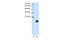 Ribosomal Protein S14 antibody, 29-258, ProSci, Enzyme Linked Immunosorbent Assay image 