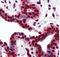 Histone Cluster 1 H2A Family Member E antibody, NB100-56346, Novus Biologicals, Immunohistochemistry paraffin image 