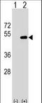 Farnesyltransferase, CAAX Box, Alpha antibody, LS-C159668, Lifespan Biosciences, Western Blot image 