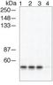 Arrestin Beta 1 antibody, GTX24472, GeneTex, Western Blot image 