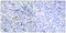 Polo Like Kinase 1 antibody, LS-C199481, Lifespan Biosciences, Immunohistochemistry paraffin image 